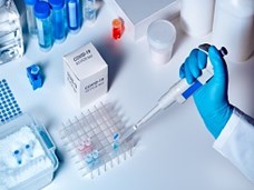 PCR לאיתור חומר גנטי של הנגיף