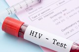 תהליכי התרבות וירוס HIV