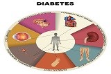 סוכרת: גורמים, מאפיינים ושכיחות