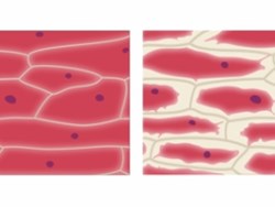 אוסמוזה בתאי בצל סגול (פלסמוליזה)