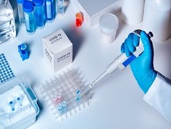 PCR לאיתור חומר גנטי של הנגיף